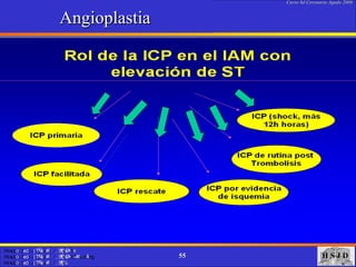 Angioplastia  