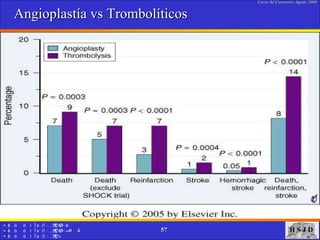 Angioplastía vs Trombolíticos 