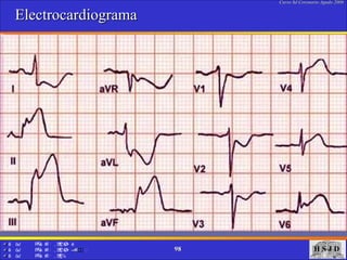 Electrocardiograma 