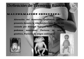 Alteración del desarrollo anatómico que se
presenta durante la vida intrauterina. Puede ser
causada por diversos factores entre los cuales
podemos    mencionar:    Factores   de    origen
genético, Factores de origen ambiental.
 