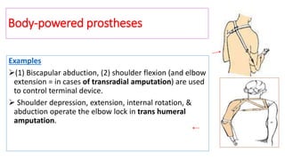 Examples
(1) Biscapular abduction, (2) shoulder flexion (and elbow
extension = in cases of transradial amputation) are used
to control terminal device.
 Shoulder depression, extension, internal rotation, &
abduction operate the elbow lock in trans humeral
amputation.
Body-powered prostheses
 