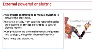 Use muscle contractions or manual switches to
activate the prosthesis.
Electrical activity from selected residual muscles
are detected by surface electrodes to control
electric motors.
Can provide more proximal function and greater
grip strength, along with improved cosmosis.
Are heavy and expensive.
External powered or electric
 