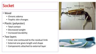 Socket
• Wood
• Chronic edema
• Trophic skin changes
• Plastic (polyester)
• Total contact
• Decreased weight
• Increased durability
• Two layers
• Inner one contoured to the residual limb
• External one gives length and shape
• Components attached to external layer
 