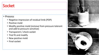 • Process
• Negative impression of residual limb (POP)
• Positive mold
• Modify positive mold (remove from pressure tolerant
and add to pressure sensitive)
• Transparent / check socket
• Trial fit and modify
• New positive mold
• Final socket
Socket
 