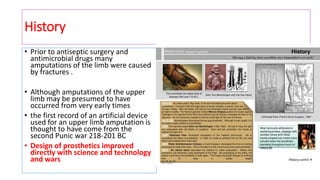 History
• Prior to antiseptic surgery and
antimicrobial drugs many
amputations of the limb were caused
by fractures .
• Although amputations of the upper
limb may be presumed to have
occurred from very early times
• the first record of an artificial device
used for an upper limb amputation is
thought to have come from the
second Punic war 218-201 BC
• Design of prosthetics improved
directly with science and technology
and wars
 
