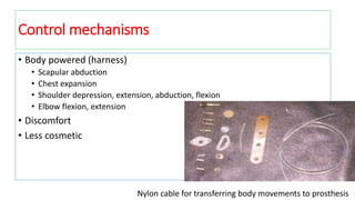 Control mechanisms
• Body powered (harness)
• Scapular abduction
• Chest expansion
• Shoulder depression, extension, abduction, flexion
• Elbow flexion, extension
• Discomfort
• Less cosmetic
Nylon cable for transferring body movements to prosthesis
 