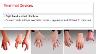 • Digit, hand, extend till elbow
• Custom made silicone cosmetic covers – expensive and difficult to maintain
Terminal Devices
 