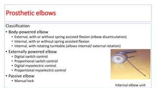 Classification
• Body-powered elbow
• External, with or without spring assisted flexion (elbow disarticulation)
• Internal, with or without spring assisted flexion
• Internal, with rotating turntable (allows internal/ external rotation)
• Externally powered elbow
• Digital switch control
• Proportional switch control
• Digital myoelectric control
• Proportional myoelectric control
• Passive elbow
• Manual lock
Prosthetic elbows
Internal elbow unit
 