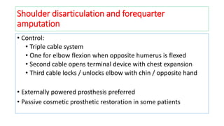 • Control:
• Triple cable system
• One for elbow flexion when opposite humerus is flexed
• Second cable opens terminal device with chest expansion
• Third cable locks / unlocks elbow with chin / opposite hand
• Externally powered prosthesis preferred
• Passive cosmetic prosthetic restoration in some patients
Shoulder disarticulation and forequarter
amputation
 