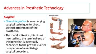 Advances in Prosthetic Technology
Surgical
• Osseointegration is an emerging
surgical technique for direct
skeletal attachment of the
prosthesis.
• The metal spike (i.e., titanium)
inserted into the terminal end of
the bone that is eventually
connected to the prosthesis after
completion of a multistage
surgical procedure.
 