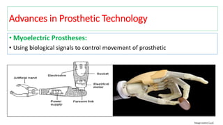 • Myoelectric Prostheses:
• Using biological signals to control movement of prosthetic
Image source [4,5]
Advances in Prosthetic Technology
 