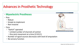 • Myoelectric Prostheses
• Pros
▫ Robust
▫ Simple to implement
▫ Non-invasive
• Cons
▫ “Switch” operated
 Limited number of channels of control
 One joint movement at a time (2 D.O.F.)
▫ Number of signal sources decreases with level of amputation
▫ No sensory function
Image source [10] Data source [6, 11]
Advances in Prosthetic Technology
 