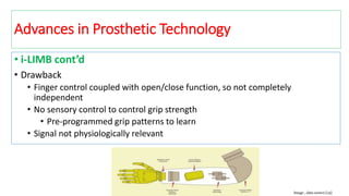 • i-LIMB cont’d
• Drawback
• Finger control coupled with open/close function, so not completely
independent
• No sensory control to control grip strength
• Pre-programmed grip patterns to learn
• Signal not physiologically relevant
Image , data source [13]
Advances in Prosthetic Technology
 