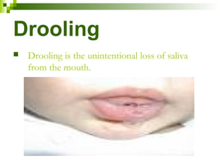 Drooling Definition Drooling Sensation Symptoms: Causes Of Drooling – PJHE
