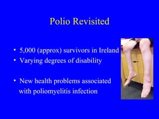 Polio Revisited 5,000 (approx) survivors in Ireland Varying degrees of disability New health problems associated  with poliomyelitis infection 