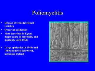 Poliomyelitis Disease of semi-developed societies Occurs in epidemics First described in Egypt,  major cause of morbidity and mortality until 1960s Large epidemics in 1940s and 1950s in developed world, including Ireland 