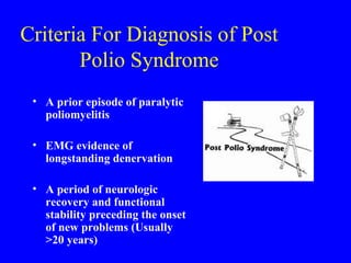 Criteria For Diagnosis of Post Polio Syndrome A prior episode of paralytic poliomyelitis EMG evidence of longstanding denervation A period of neurologic recovery and functional stability preceding the onset of new problems (Usually >20 years) 