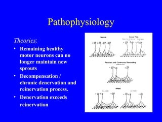 Pathophysiology Theories : Remaining healthy motor neurons can no longer maintain new sprouts Decompensation / chronic denervation and reinervation process. Denervation exceeds reinervation   