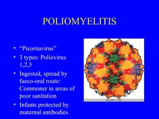 POLIOMYELITIS “ Picornavirus” 3 types: Poliovirus 1,2,3 Ingested, spread by faeco-oral route: Commoner in areas of poor sanitation Infants protected by maternal antibodies 