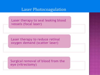Laser Photocoagulation
 