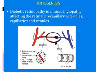 PATHOGENESIS
 Diabetic retinopathy is a microangiopathy
affecting the retinal precapillary arterioles,
capillaries and venules .
 