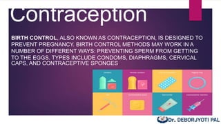 Contraception
BIRTH CONTROL, ALSO KNOWN AS CONTRACEPTION, IS DESIGNED TO
PREVENT PREGNANCY. BIRTH CONTROL METHODS MAY WORK IN A
NUMBER OF DIFFERENT WAYS: PREVENTING SPERM FROM GETTING
TO THE EGGS. TYPES INCLUDE CONDOMS, DIAPHRAGMS, CERVICAL
CAPS, AND CONTRACEPTIVE SPONGES.
 