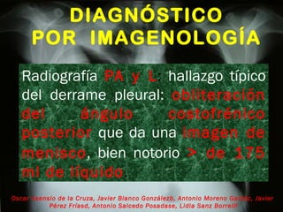 DIAGNÓSTICO POR  IMAGENOLOGÍA Oscar Asensio de la Cruza, Javier Blanco Gonzálezb, Antonio Moreno Galdóc, Javier  Pérez Fríasd, Antonio Salcedo Posadase, Lidia Sanz Borrellf Radiografía   PA y L :  hallazgo típico del derrame pleural:  obliteración del ángulo costofrénico posterior   que da una  imagen de menisco , bien notorio  >  de 175 ml de líquido . 