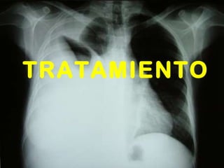 TRATAMIENTO 