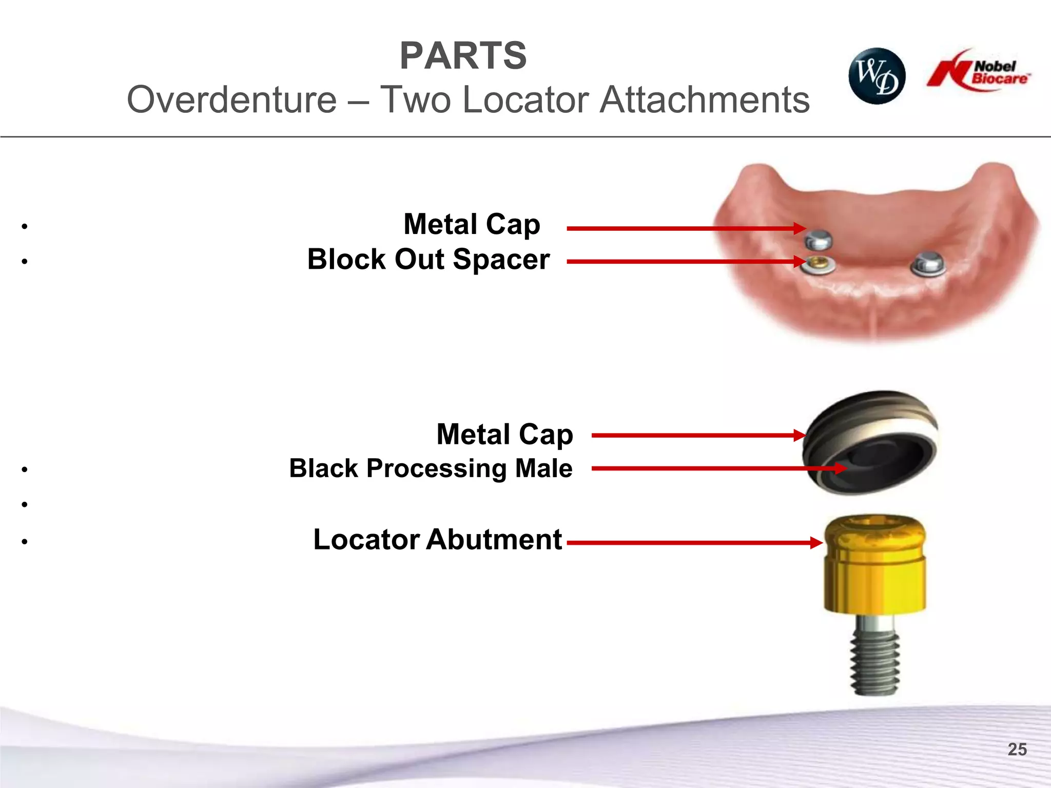 PARTS
    Overdenture – Two Locator Attachments


•                  Metal Cap
•            Block Out Spacer




                      Metal Cap
•           Black Processing Male
•
•             Locator Abutment




                                            25
 