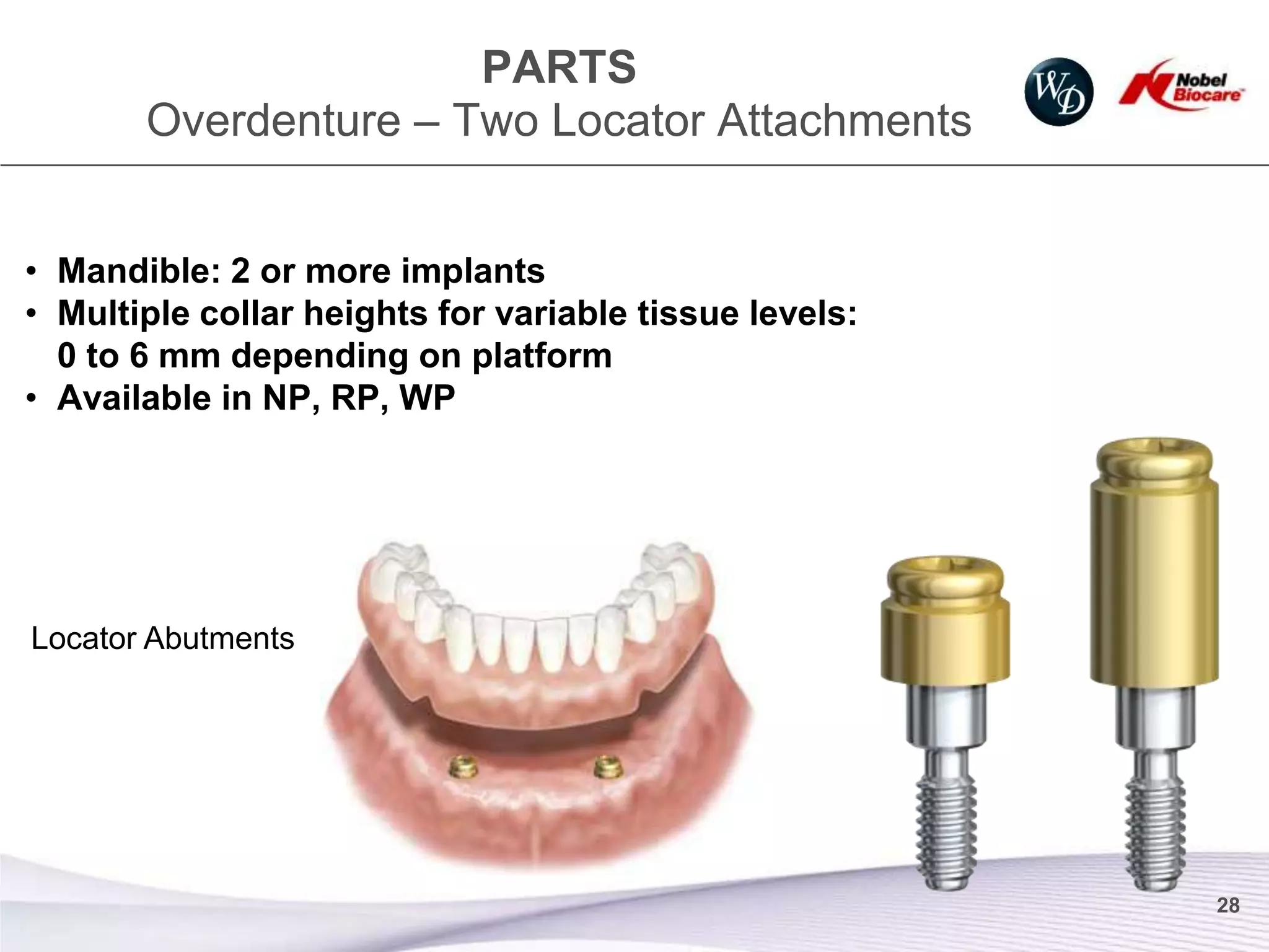 PARTS
       Overdenture – Two Locator Attachments


• Mandible: 2 or more implants
• Multiple collar heights for variable tissue levels:
  0 to 6 mm depending on platform
• Available in NP, RP, WP




Locator Abutments




                                                        28
 