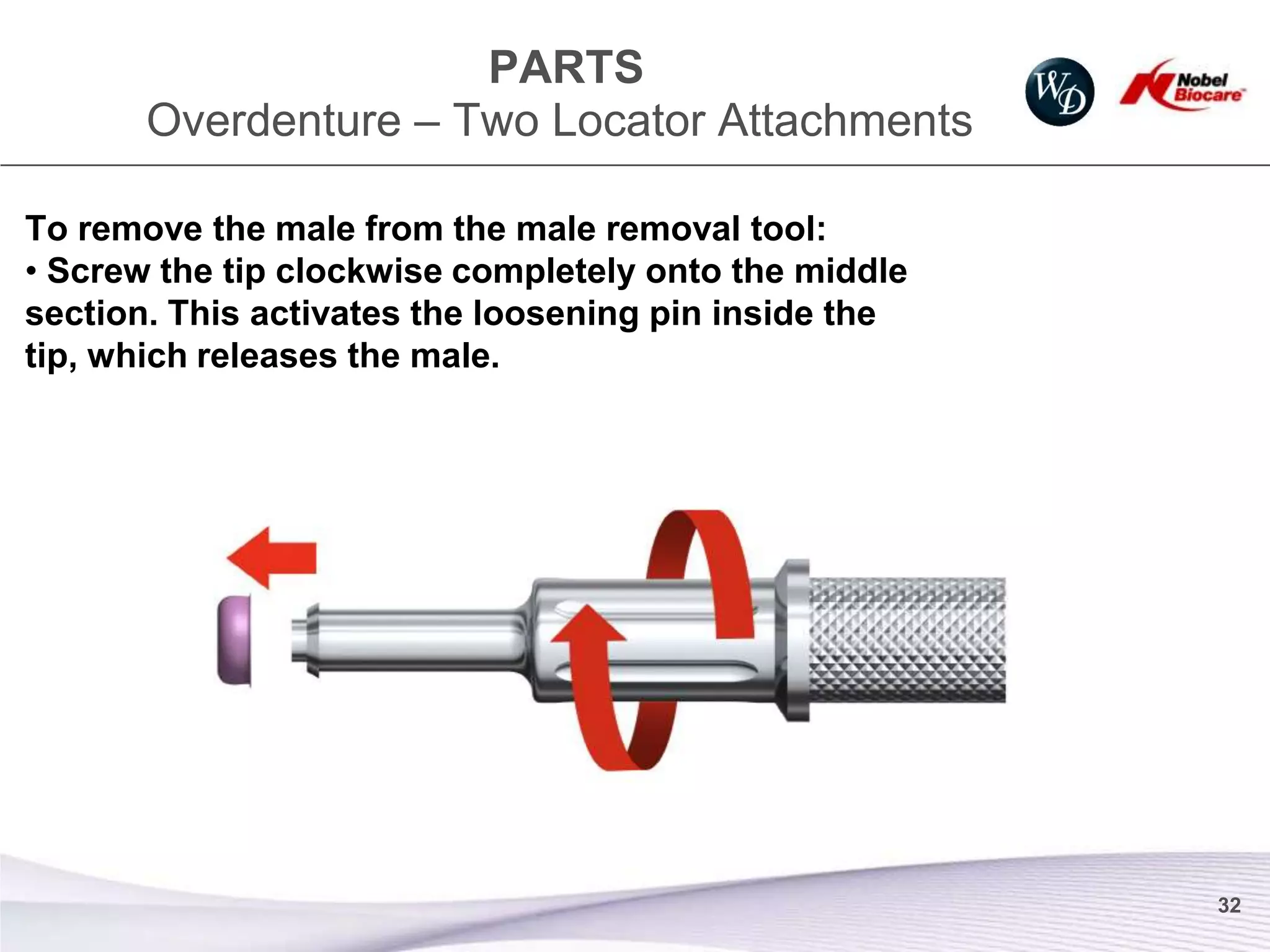 PARTS
       Overdenture – Two Locator Attachments

To remove the male from the male removal tool:
• Screw the tip clockwise completely onto the middle
section. This activates the loosening pin inside the
tip, which releases the male.




                                                       32
 