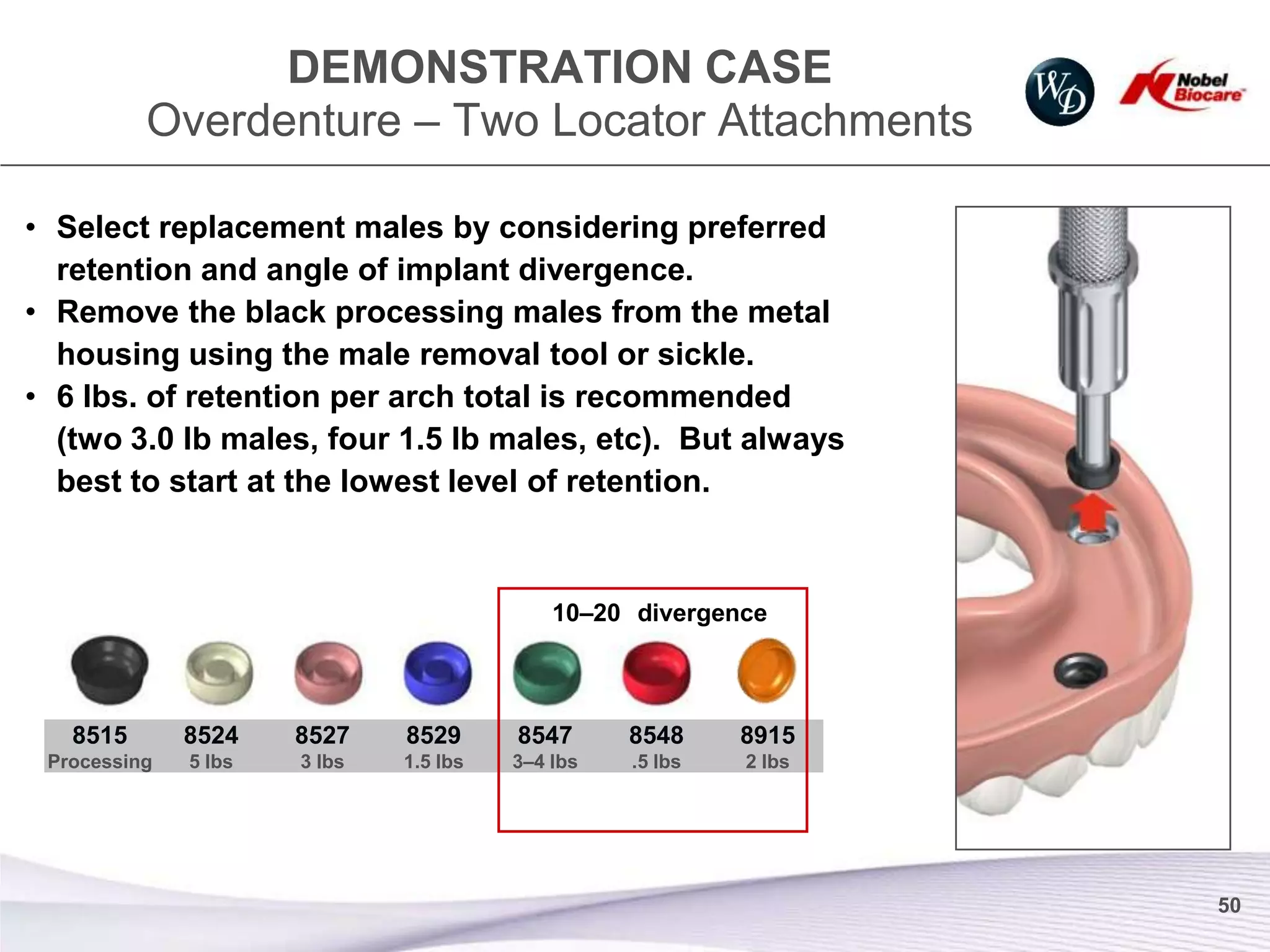 DEMONSTRATION CASE
          Overdenture – Two Locator Attachments

• Select replacement males by considering preferred
  retention and angle of implant divergence.
• Remove the black processing males from the metal
  housing using the male removal tool or sickle.
• 6 lbs. of retention per arch total is recommended
  (two 3.0 lb males, four 1.5 lb males, etc). But always
  best to start at the lowest level of retention.



                                            10–20 divergence



   8515       8524    8527    8529      8547      8548     8915
 Processing   5 lbs   3 lbs   1.5 lbs   3–4 lbs   .5 lbs   2 lbs




                                                                   50
 