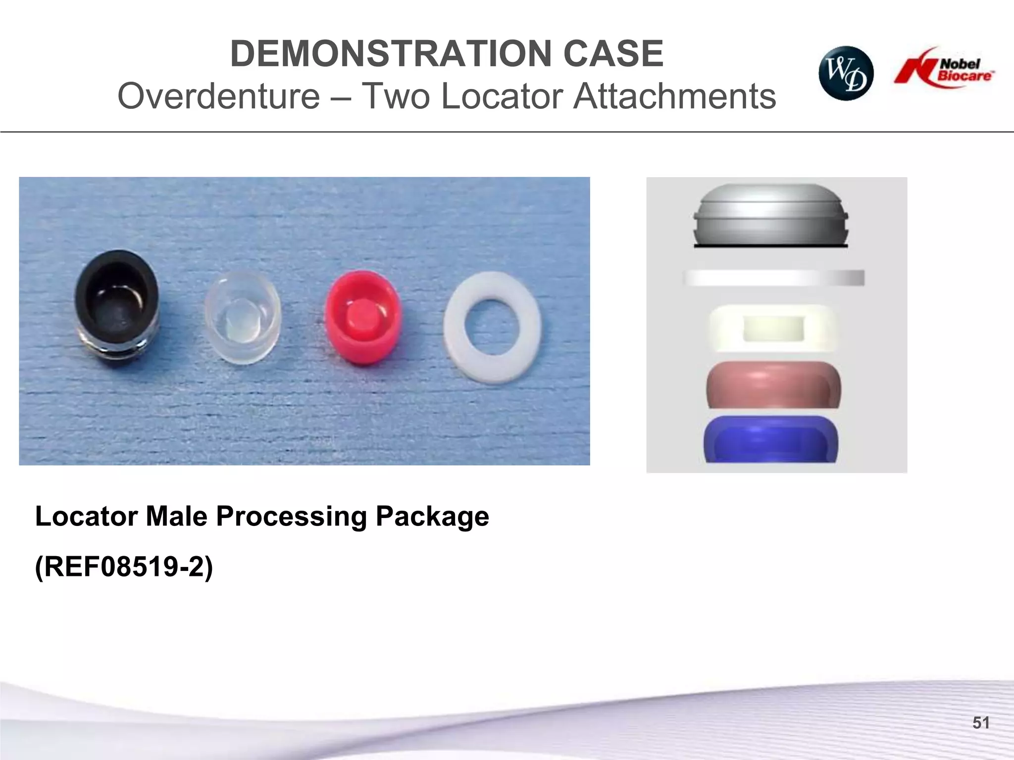DEMONSTRATION CASE
     Overdenture – Two Locator Attachments




Locator Male Processing Package
(REF08519-2)




                                             51
 