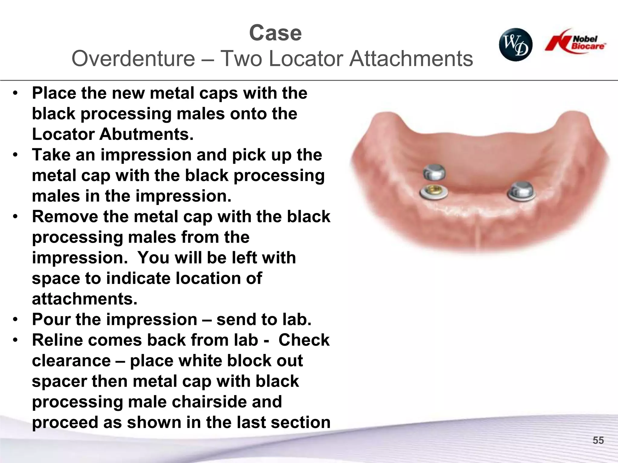 Case
       Overdenture – Two Locator Attachments
• Place the new metal caps with the
  black processing males onto the
  Locator Abutments.
• Take an impression and pick up the
  metal cap with the black processing
  males in the impression.
• Remove the metal cap with the black
  processing males from the
  impression. You will be left with
  space to indicate location of
  attachments.
• Pour the impression – send to lab.
• Reline comes back from lab - Check
  clearance – place white block out
  spacer then metal cap with black
  processing male chairside and
  proceed as shown in the last section
                                               55
 