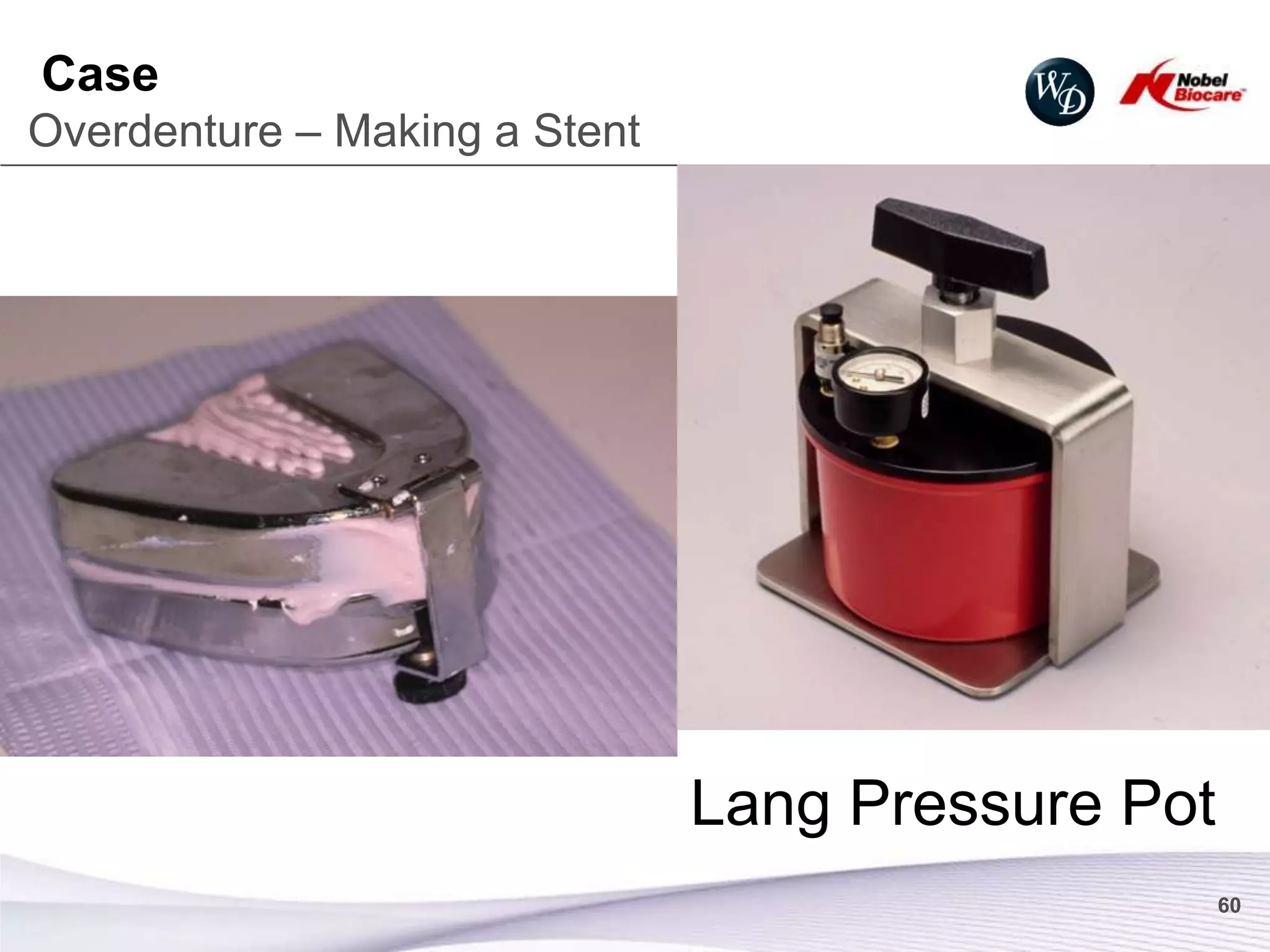 Case
Overdenture – Making a Stent




                               Lang Pressure Pot
                                                   60
 