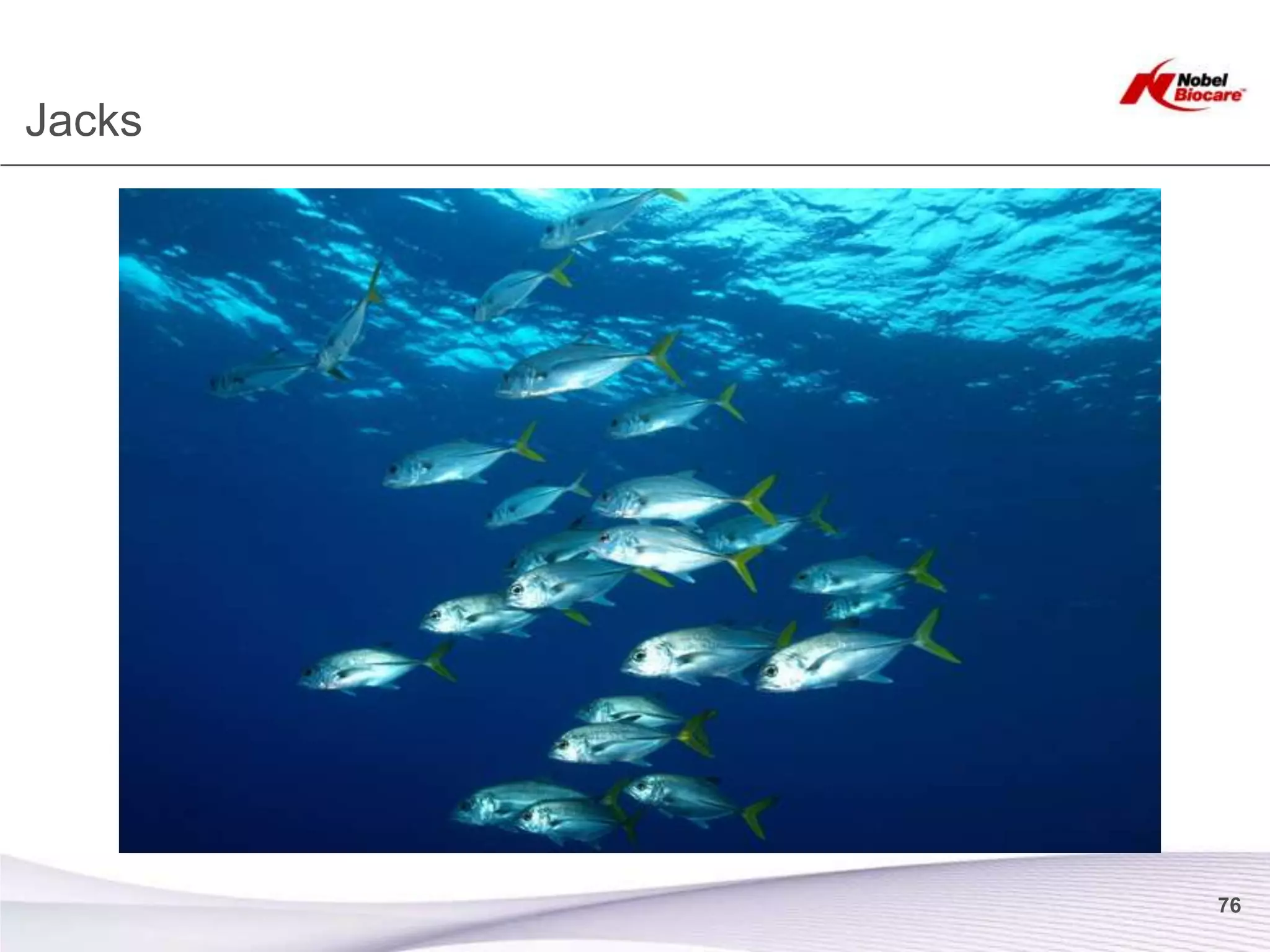 Jacks




        76
 