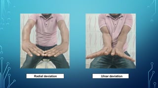Radial deviation Ulnar deviation
 