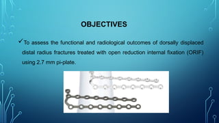 OBJECTIVES
To assess the functional and radiological outcomes of dorsally displaced
distal radius fractures treated with open reduction internal fixation (ORIF)
using 2.7 mm pi-plate.
 