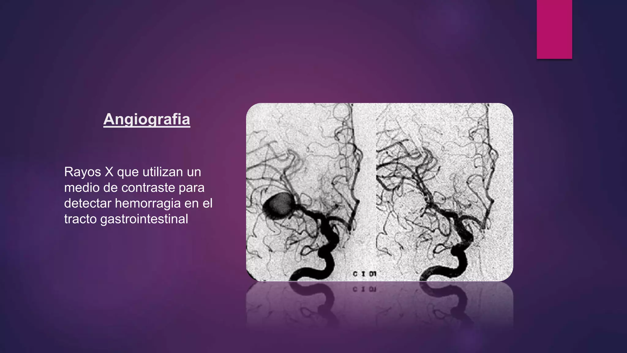 Angiografia
Rayos X que utilizan un
medio de contraste para
detectar hemorragia en el
tracto gastrointestinal
 