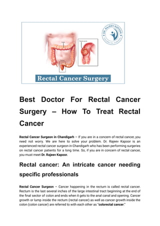 Best Doctor For Rectal Cancer
Surgery – How To Treat Rectal
Cancer
Rectal Cancer Surgeon in Chandigarh – If you are in a concern of rectal cancer, you
need not worry. We are here to solve your problem. Dr. Rajeev Kapoor is an
experienced rectal cancer surgeon in Chandigarh who has been performing surgeries
on rectal cancer patients for a long time. So, if you are in concern of rectal cancer,
you must meet Dr. Rajeev Kapoor.
Rectal cancer: An intricate cancer needing
specific professionals
Rectal Cancer Surgeon – Cancer happening in the rectum is called rectal cancer.
Rectum is the last several inches of the large intestinal tract beginning at the end of
the final sector of colon and ends when it gets to the anal canal and opening. Cancer
growth or lump inside the rectum (rectal cancer) as well as cancer growth inside the
colon (colon cancer) are referred to with each other as “colorectal cancer.”
 