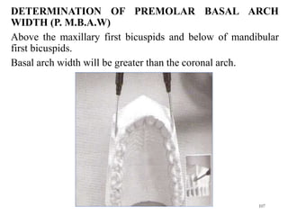 DETERMINATION OF PREMOLAR BASAL ARCH
WIDTH (P. M.B.A.W)
Above the maxillary first bicuspids and below of mandibular
first bicuspids.
Basal arch width will be greater than the coronal arch.
107
 