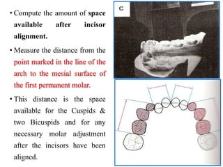 • Compute the amount of space
available after incisor
alignment.
• Measure the distance from the
point marked in the line of the
arch to the mesial surface of
the first permanent molar.
• This distance is the space
available for the Cuspids &
two Bicuspids and for any
necessary molar adjustment
after the incisors have been
aligned.
 