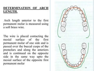 DETERMINATION OF ARCH
LENGTH.
Arch length anterior to the first
permanent molar is measured using
a soft brass wire.
The wire is placed contacting the
mesial surface of the first
permanent molar of one side and is
passed over the buccal cusps of the
premolars and along the anteriors
and is continued on the opposite
side in the same way upto the
mesial surface of the opposite first
permanent molar
98
.
 