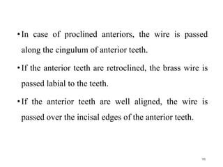 •In case of proclined anteriors, the wire is passed
along the cingulum of anterior teeth.
•If the anterior teeth are retroclined, the brass wire is
passed labial to the teeth.
•If the anterior teeth are well aligned, the wire is
passed over the incisal edges of the anterior teeth.
99
 