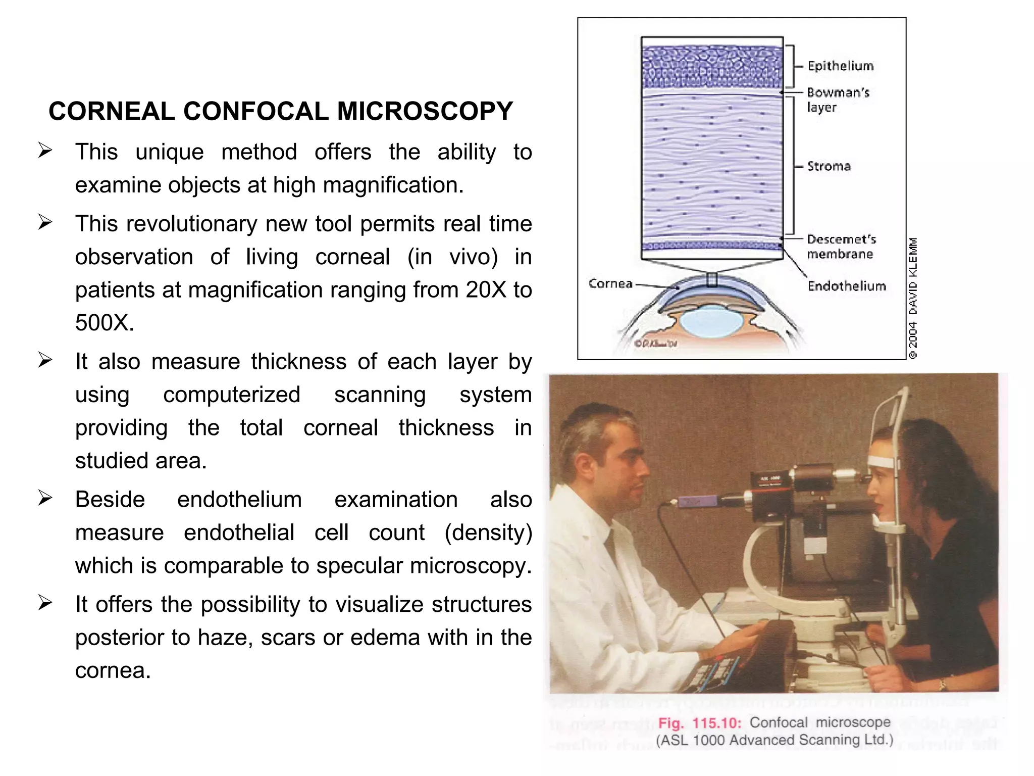 CORNEAL CONFOCAL MICROSCOPY
 This unique method offers the ability to
  examine objects at high magnification.
 This revolutionary new tool permits real time
  observation of living corneal (in vivo) in
  patients at magnification ranging from 20X to
  500X.
 It also measure thickness of each layer by
  using computerized scanning system
  providing the total corneal thickness in
  studied area.
 Beside endothelium examination also
  measure endothelial cell count (density)
  which is comparable to specular microscopy.
 It offers the possibility to visualize structures
  posterior to haze, scars or edema with in the
  cornea.
 