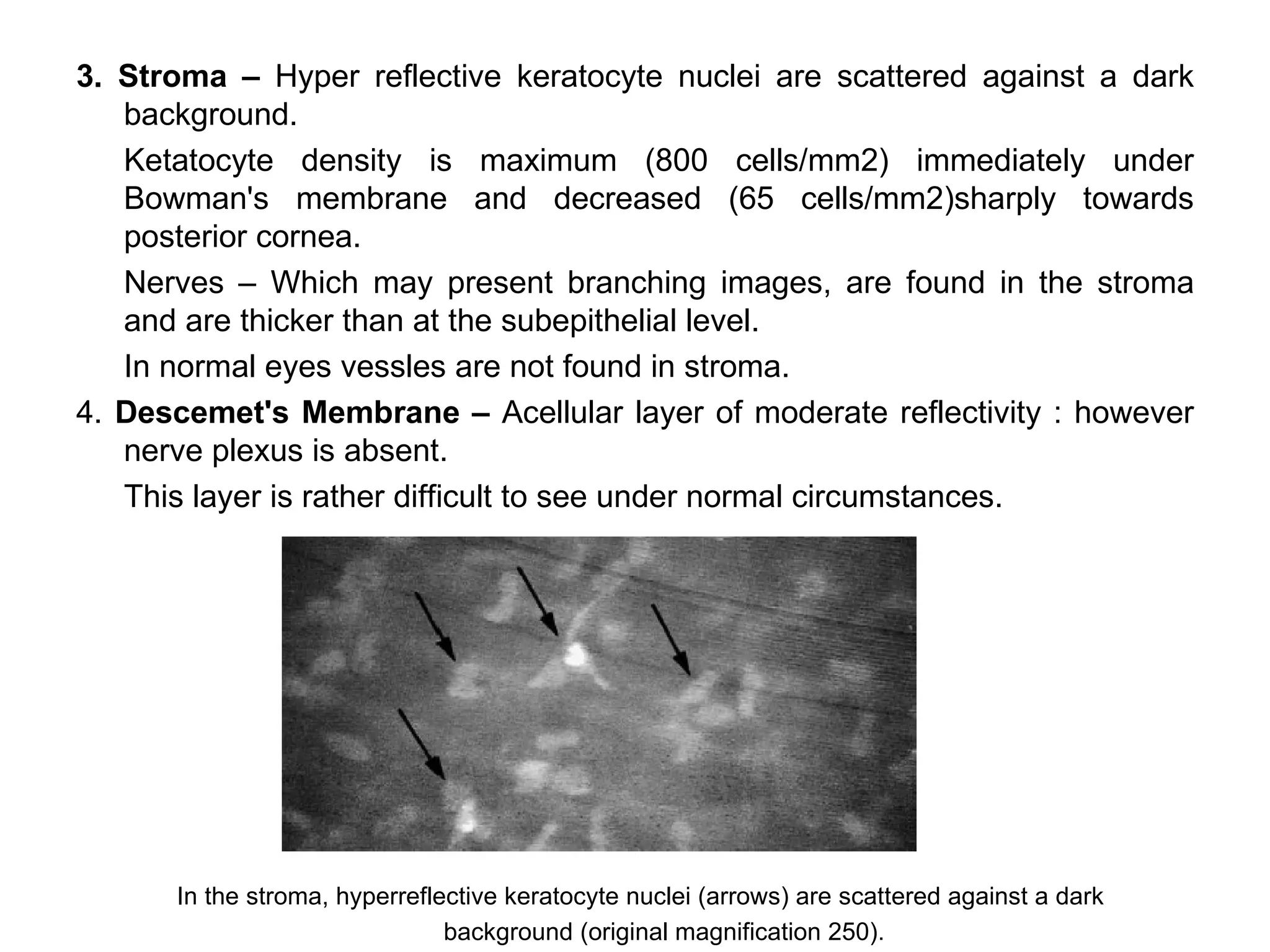3. Stroma – Hyper reflective keratocyte nuclei are scattered against a dark
   background.
   Ketatocyte density is maximum (800 cells/mm2) immediately under
   Bowman's membrane and decreased (65 cells/mm2)sharply towards
   posterior cornea.
   Nerves – Which may present branching images, are found in the stroma
   and are thicker than at the subepithelial level.
   In normal eyes vessles are not found in stroma.
4. Descemet's Membrane – Acellular layer of moderate reflectivity : however
   nerve plexus is absent.
   This layer is rather difficult to see under normal circumstances.




      In the stroma, hyperreflective keratocyte nuclei (arrows) are scattered against a dark
                               background (original magnification 250).
 