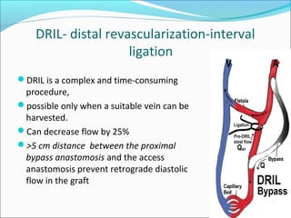 Strained Dil Management of steal syndrome || Dr Ravi Bansal | PPT
