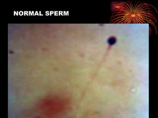 NORMAL SPERM 