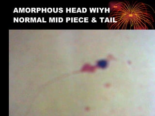 AMORPHOUS HEAD WIYH NORMAL MID PIECE & TAIL 