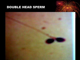 DOUBLE HEAD SPERM 